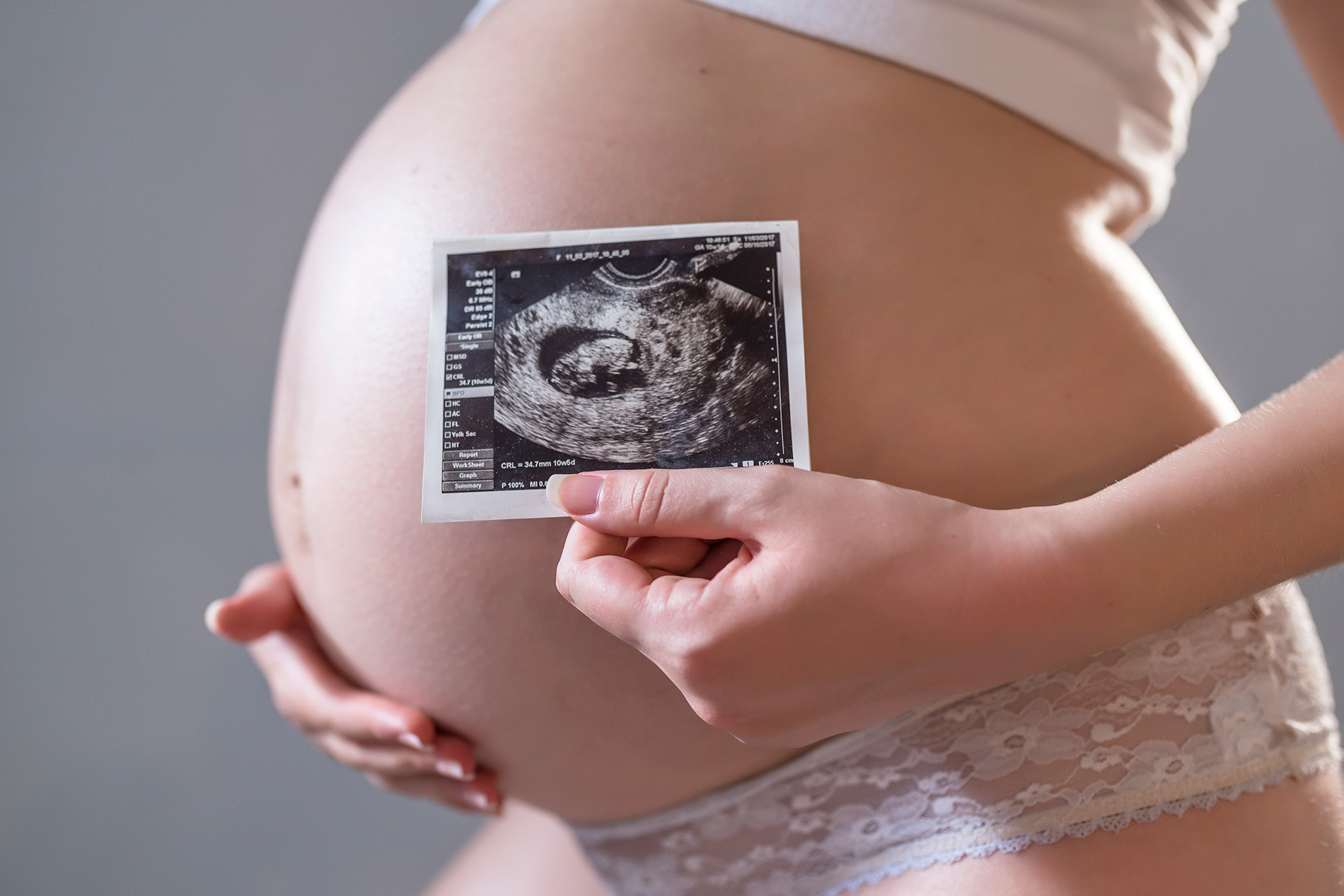 pregnant woman holding x ray front her belly high